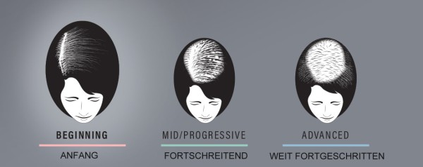 hair-progress